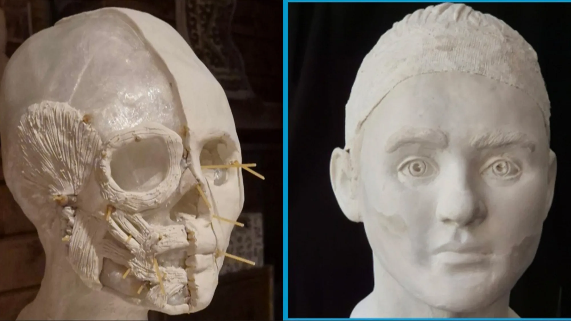 Two images showing a skull and a boy's face.