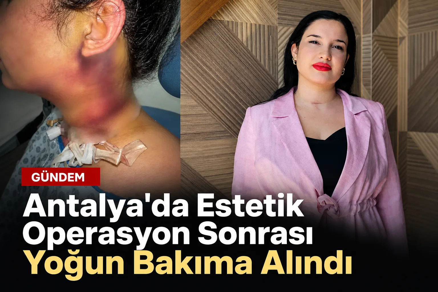 Antalya'da Estetik Operasyon Sonrası Yoğun Bakıma Alındı
