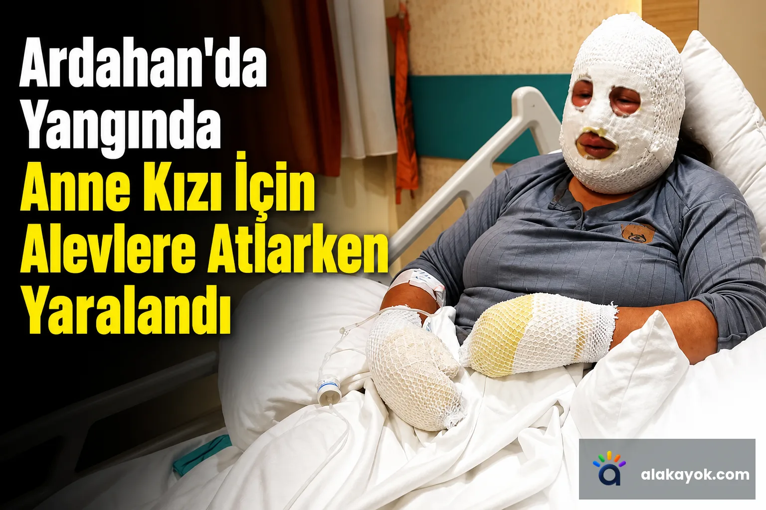 Ardahan'da Yangında Anne Kızı İçin Alevlere Atlarken Yaralandı
