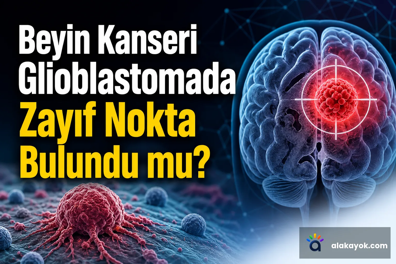 Beyin Kanseri Glioblastomada Zayıf Nokta Bulundu mu?
