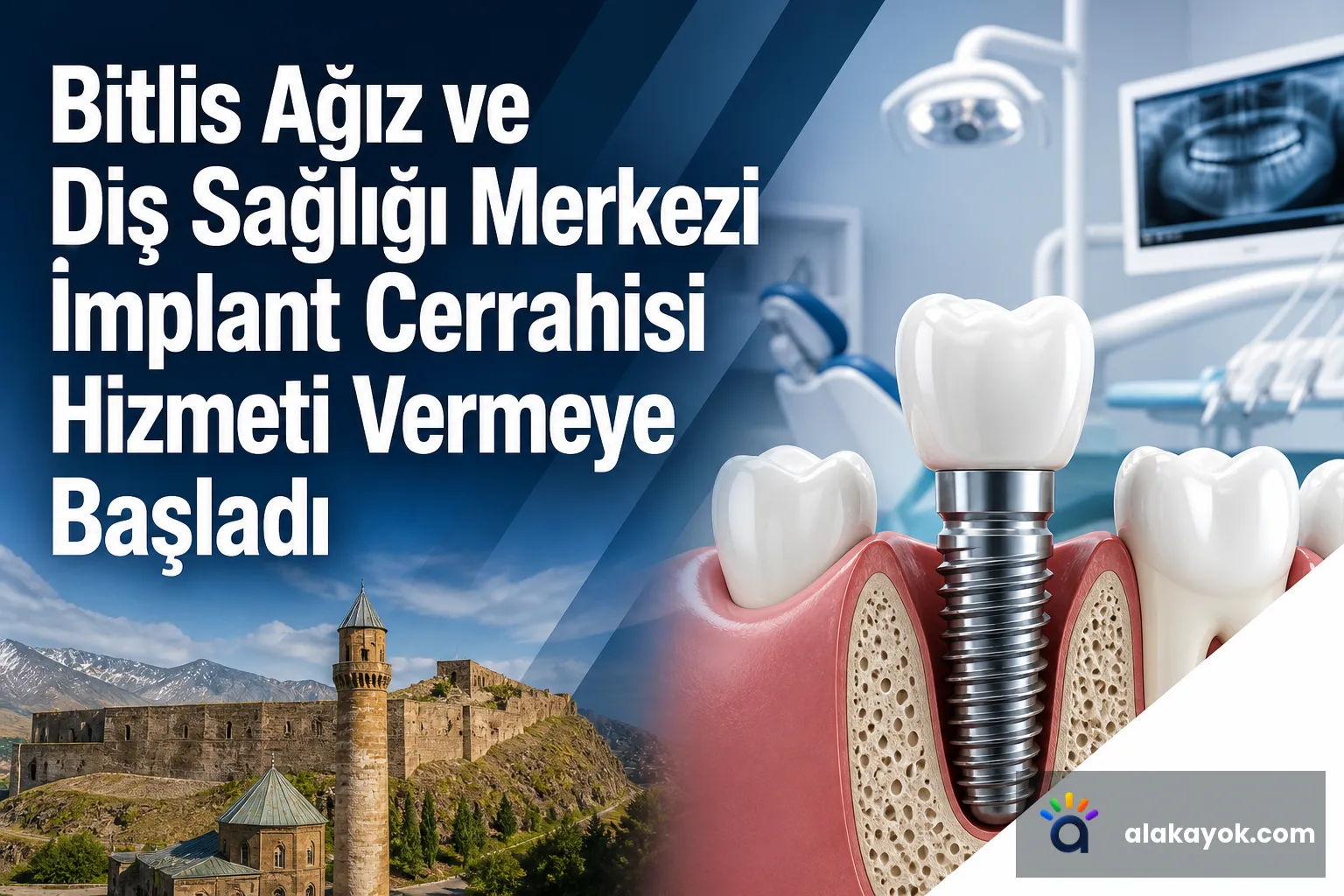 Bitlis Ağız ve Diş Sağlığı Merkezi İmplant Cerrahisi Hizmeti Vermeye Başladı