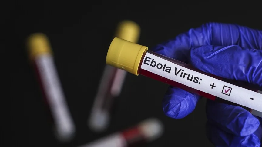 Ebola Virüsü Fransa'da Tespit Edildi