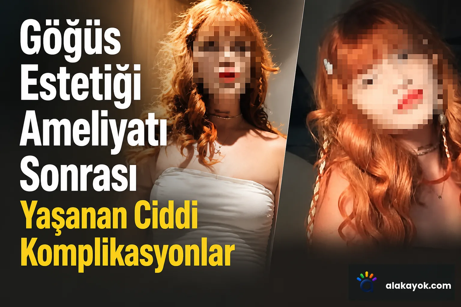 Göğüs Estetiği Ameliyatı Sonrası Yaşanan Ciddi Komplikasyonlar