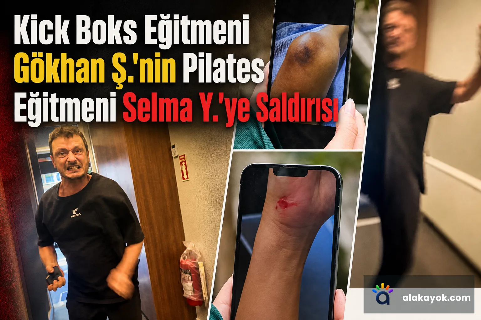 Kick Boks Eğitmeni Gökhan Ş.'nin Pilates Eğitmeni Selma Y.'ye Saldırısı