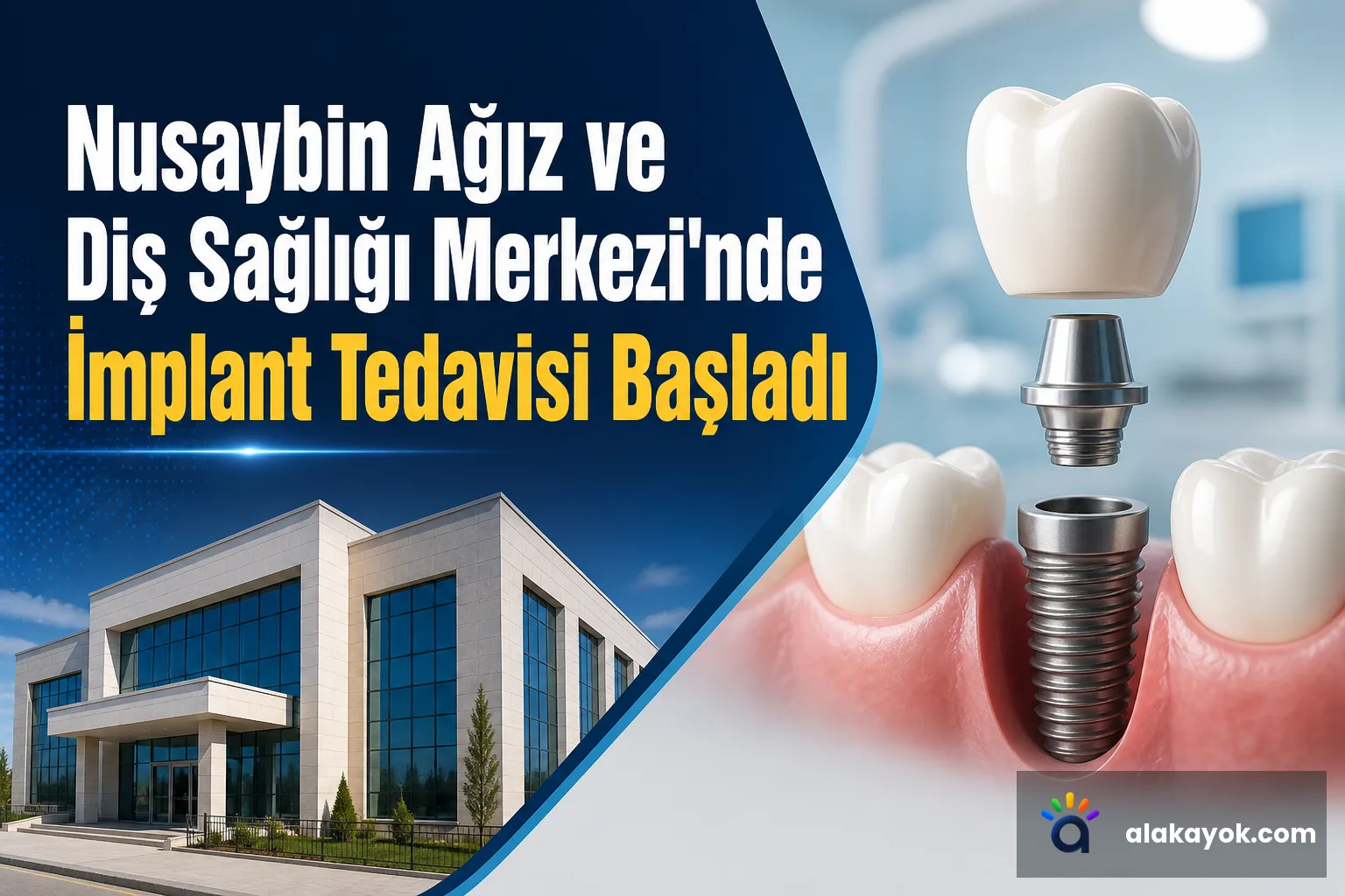 Nusaybin Ağız ve Diş Sağlığı Merkezi'nde İmplant Tedavisi Başladı
