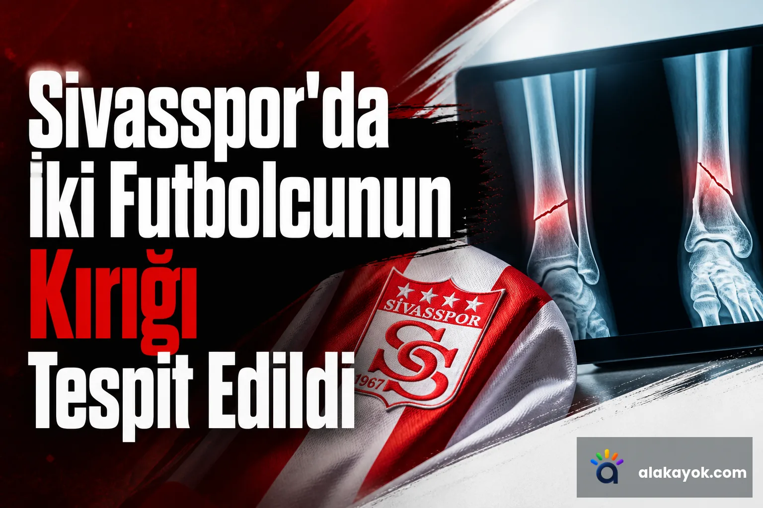Sivasspor'da İki Futbolcunun Kırığı Tespit Edildi