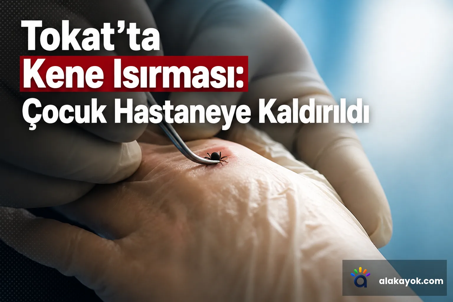 Tokat’ta Kene Isırması: Çocuk Hastaneye Kaldırıldı