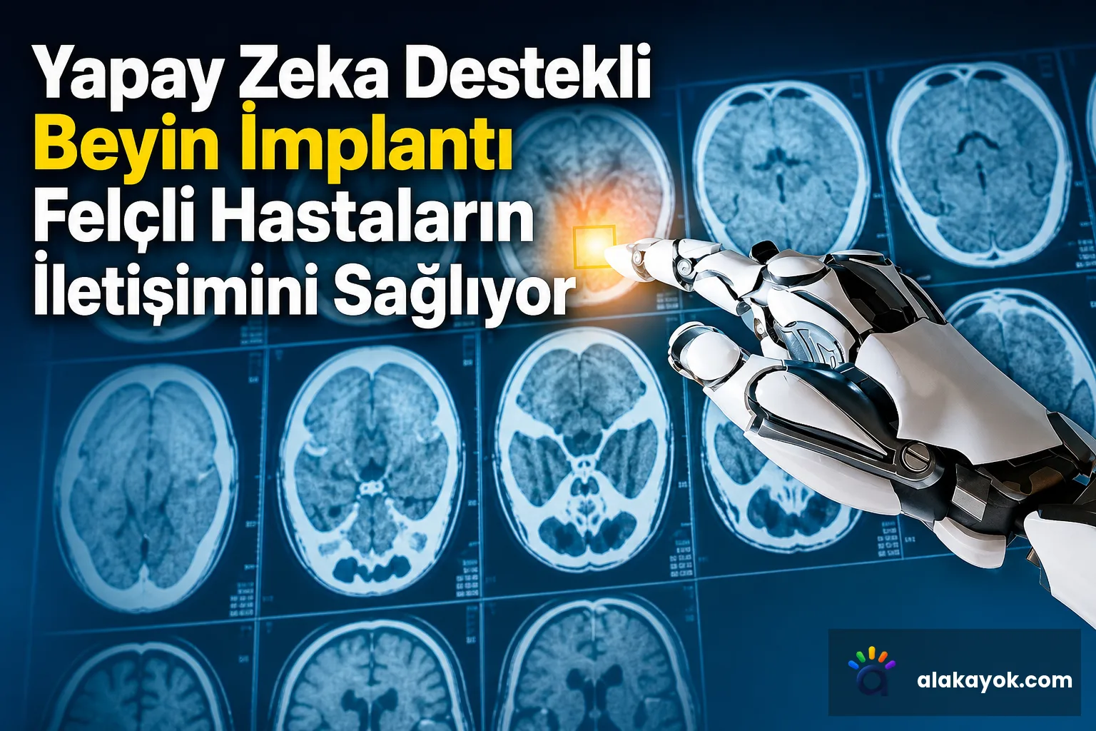 Yapay Zeka Destekli Beyin İmplantı Felçli Hastaların İletişimini Sağlıyor
